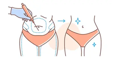 پیکرتراشی و ابدومینوپلاستی