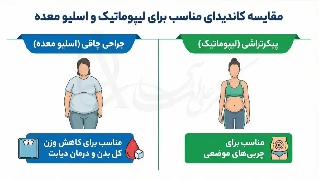 مقایسه کاندیدای مناسب برای لیپوماتیک و اسلیو معده