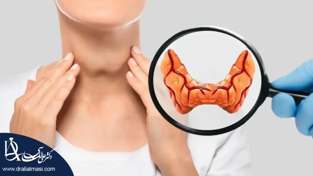 قاتل کم کاری تیروئید