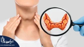 قاتل کم کاری تیروئید