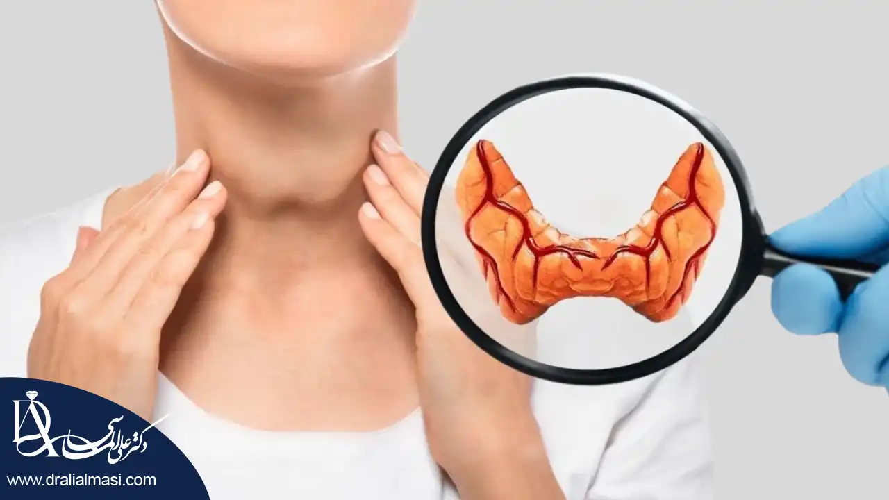 قاتل کم کاری تیروئید