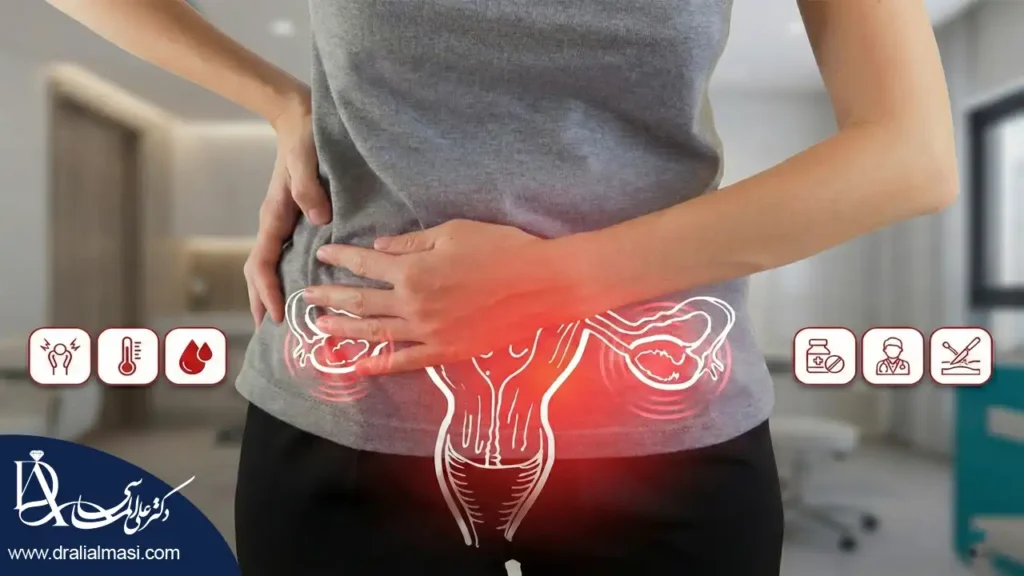 قاتل کیست تخمدان