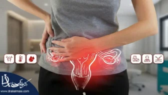 قاتل کیست تخمدان