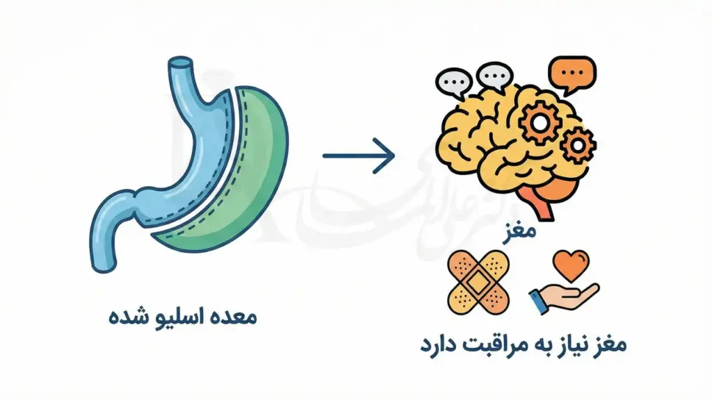 تاثیر اسلیو معده بر پرخوری عصبی