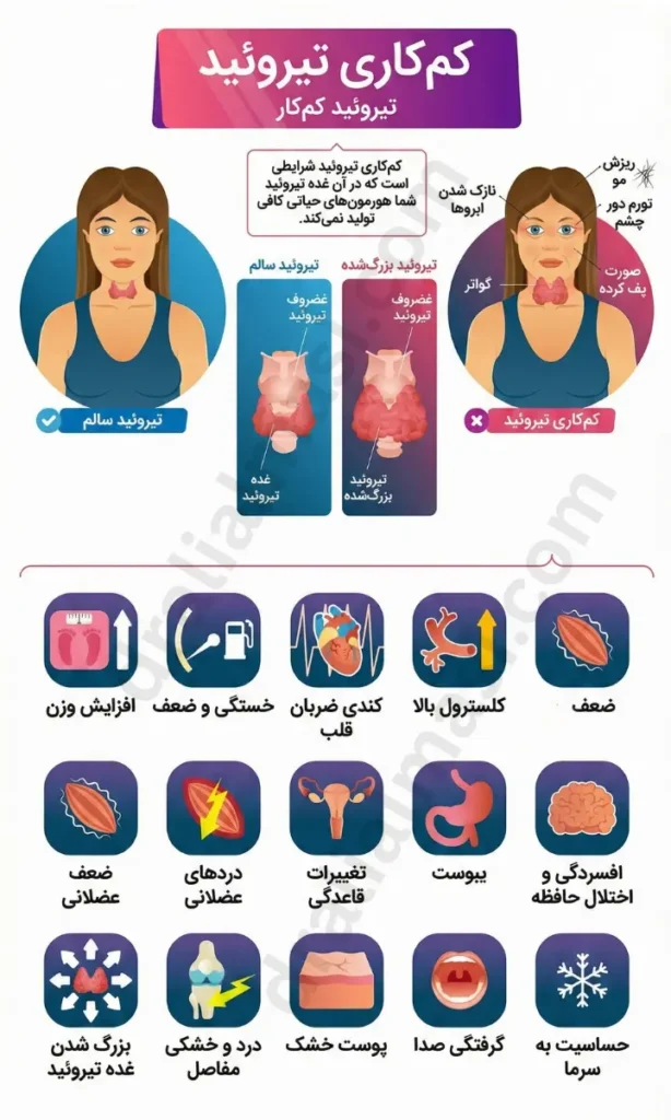 اینفوگرافیک علائم کم کاری تیروئید در زنان شامل چاقی ریزش مو و خستگی
