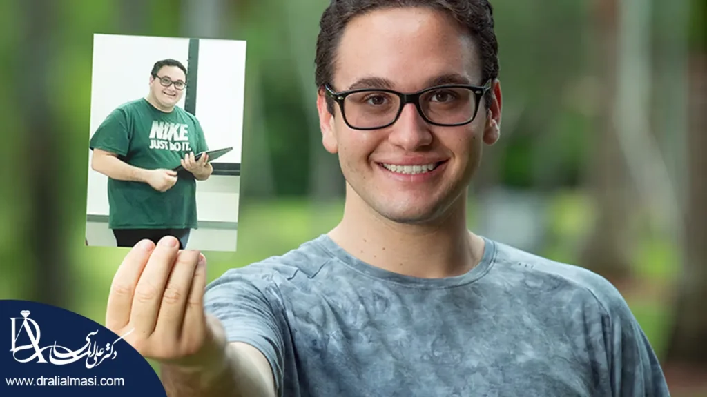 زندگی بعد از عمل اسلیو معده در کودکان