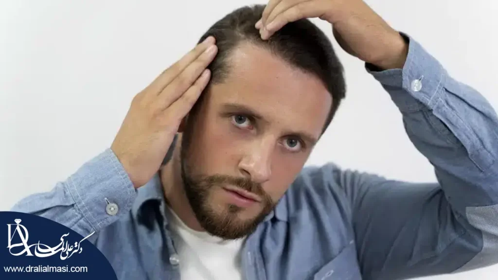 ریزش مو بعد از عمل اسلیو معده