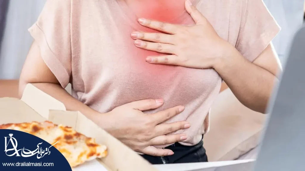 رفلاکس اسید معده بعد از عمل اسلیو