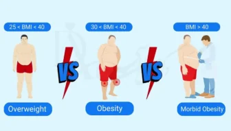 فرق اضافه وزن و چاقی