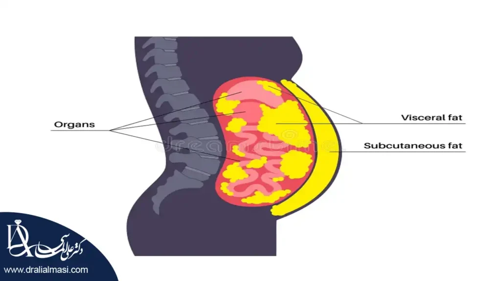 تفاوت میان چربی احشایی و چربی زیر پوستی