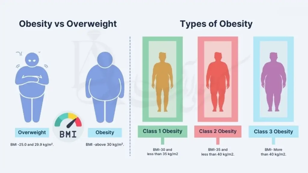 درجه بندی انواع چاقی