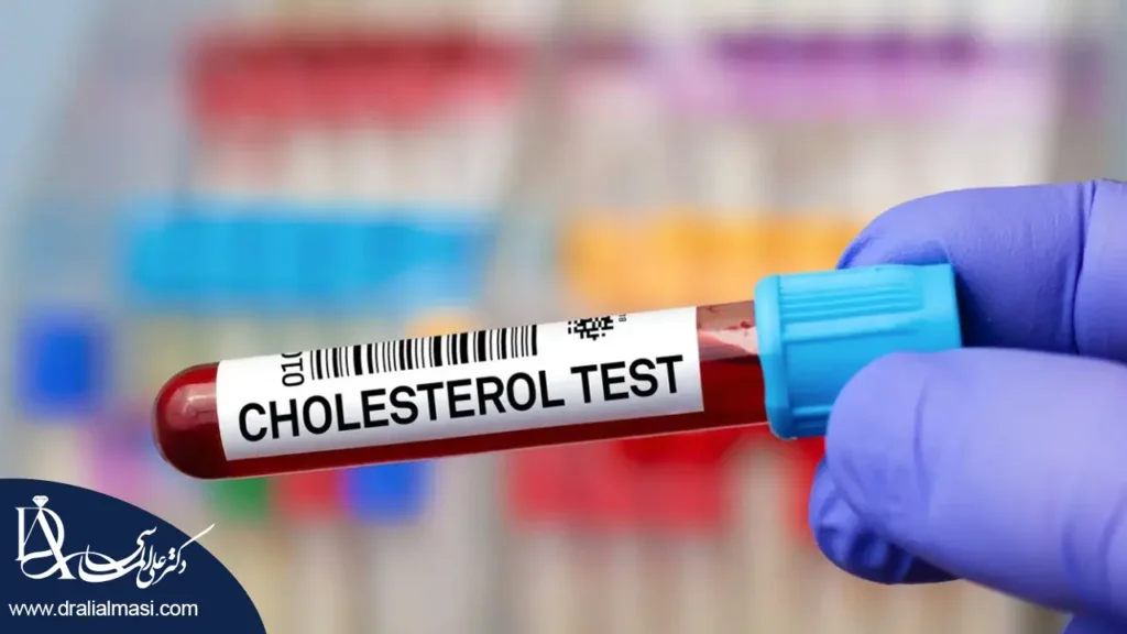 تست کلسترول