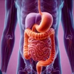 گشاد شدن معده بعد از عمل اسلیو