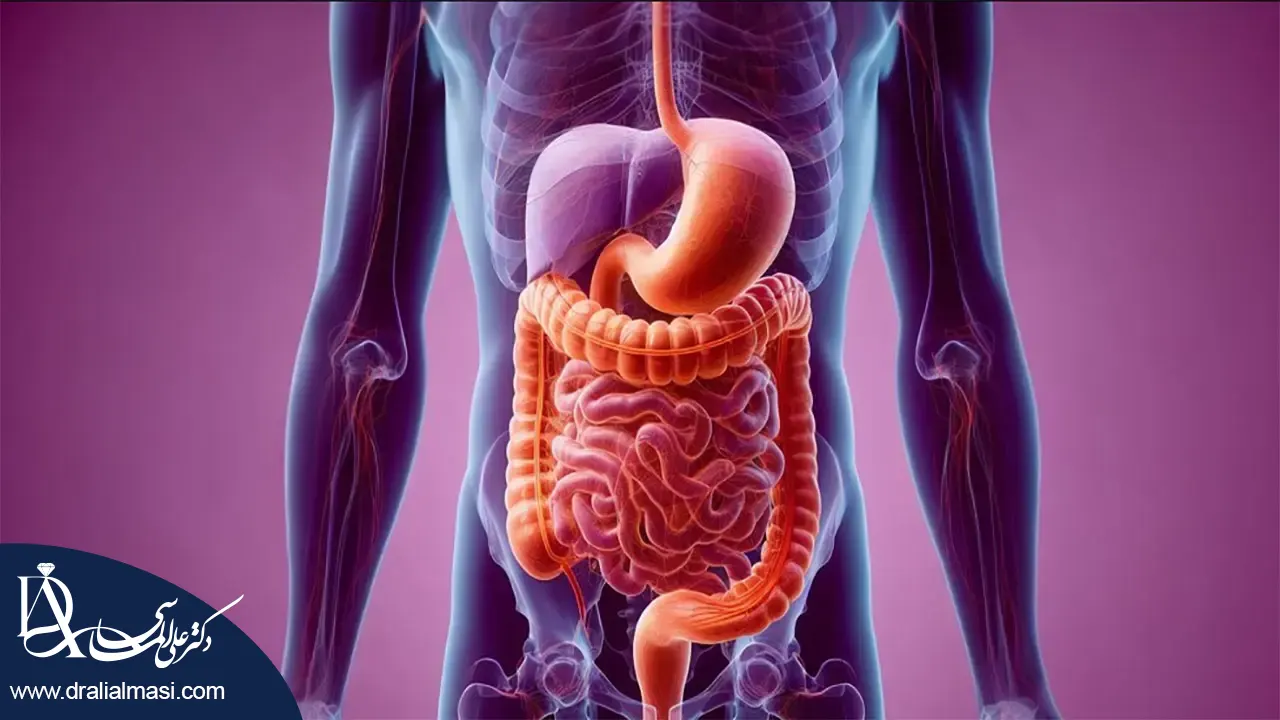 گشاد شدن معده بعد از عمل اسلیو