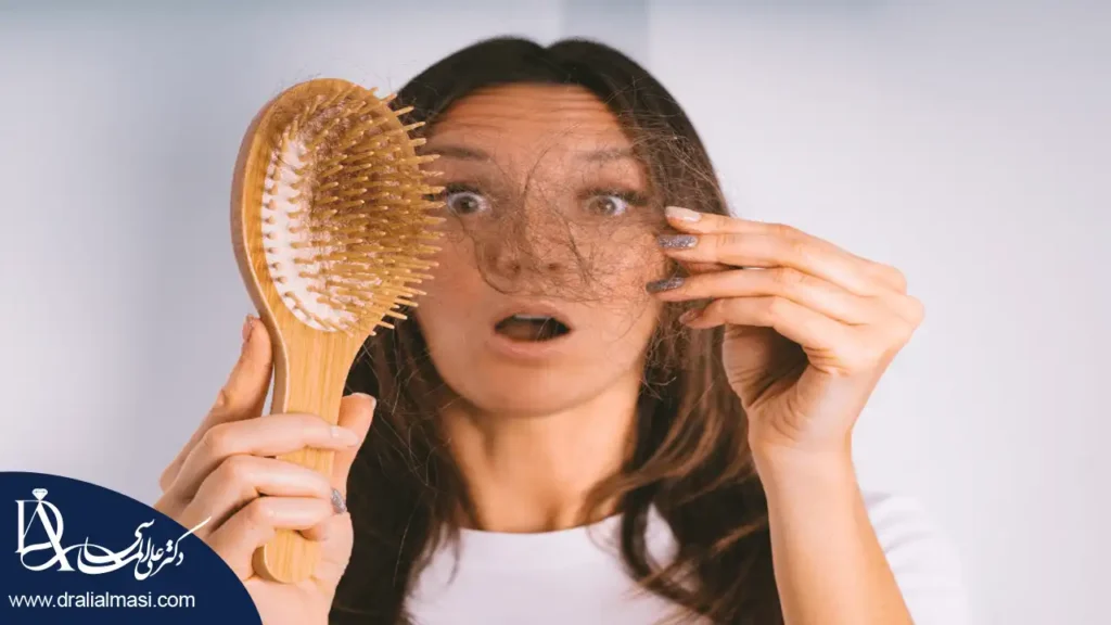 ریزش مو بعد از عمل اسلیو