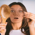 ریزش مو بعد از عمل اسلیو