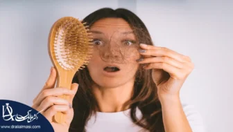 ریزش مو بعد از عمل اسلیو