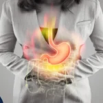 سوزش معده بعد از عمل اسلیو