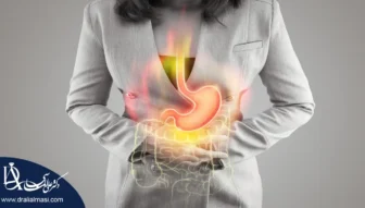 سوزش معده بعد از عمل اسلیو