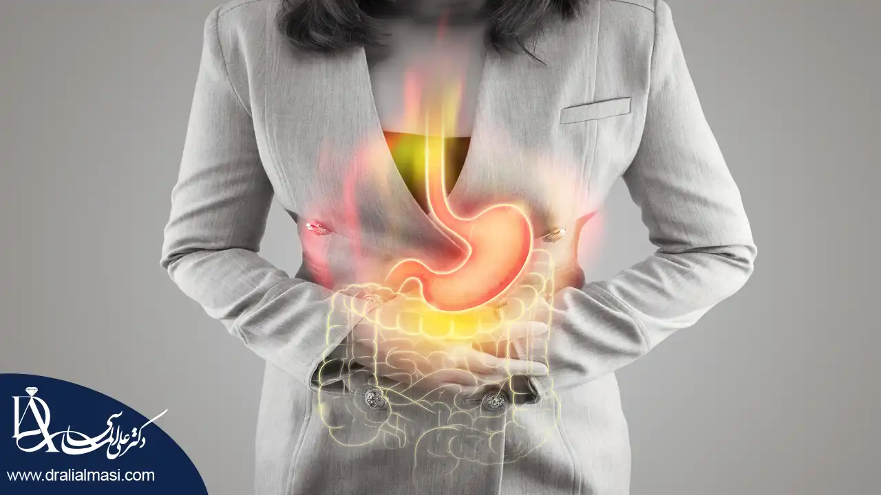 سوزش معده بعد از عمل اسلیو