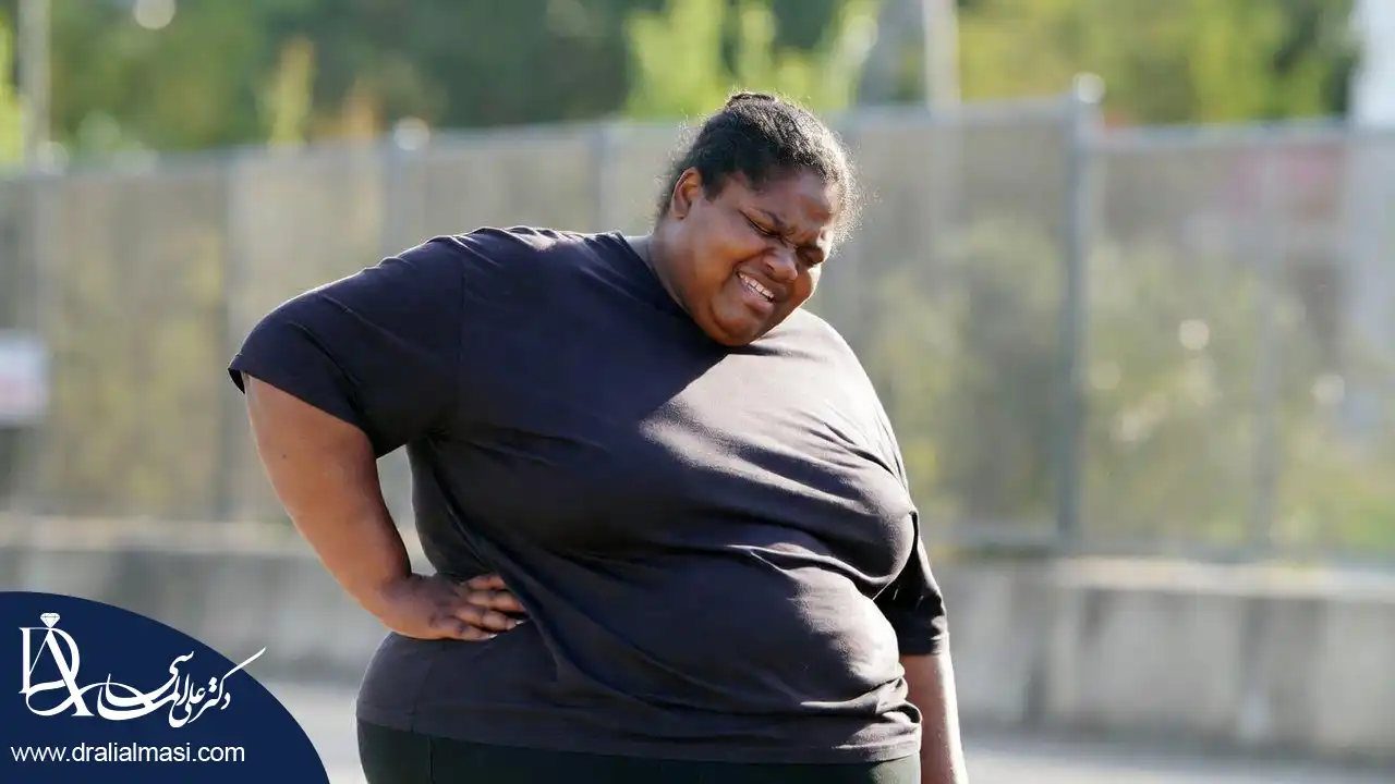 چاقی و تاثیر آن بر کمر درد