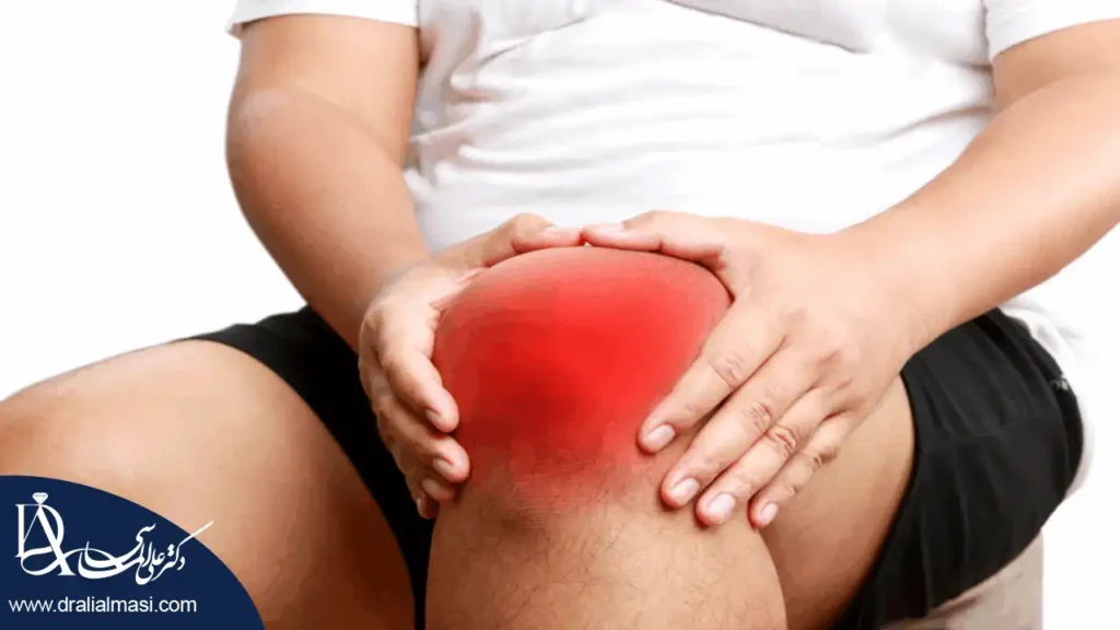 تصویر فردی که زانو درد دارد