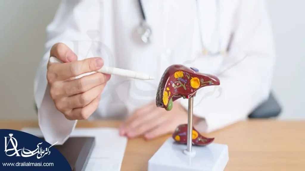 درمان کبد چرب با عمل لاغری