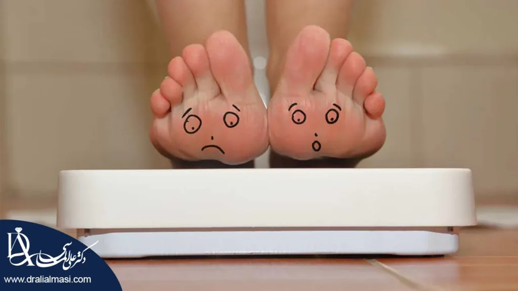 استپ وزن بعد از عمل لاغری