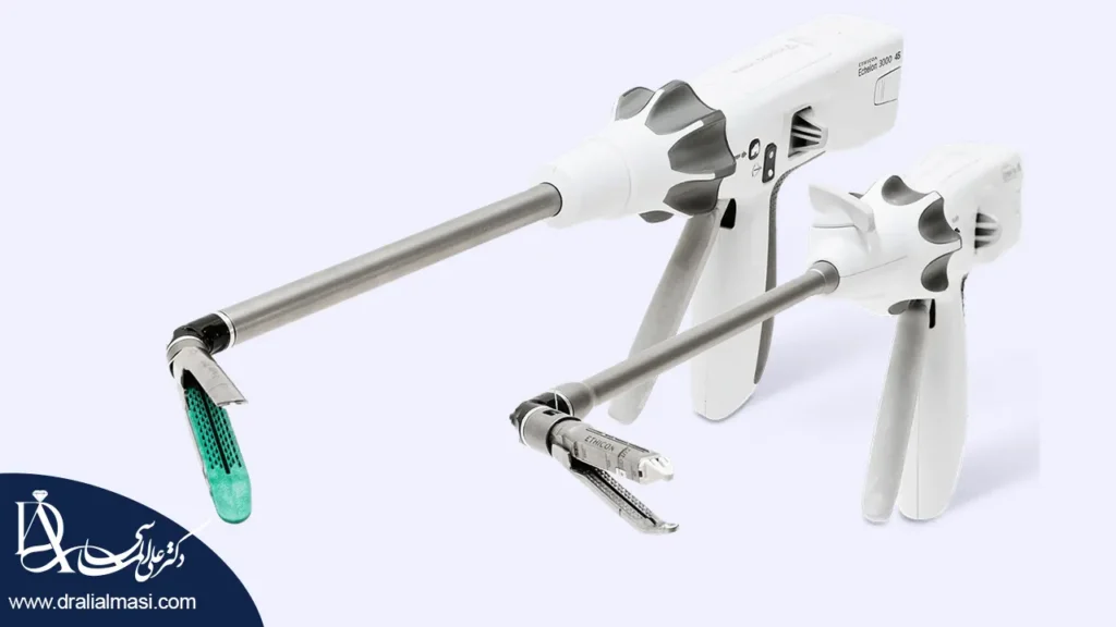 عکس منگنه اسلیو معده