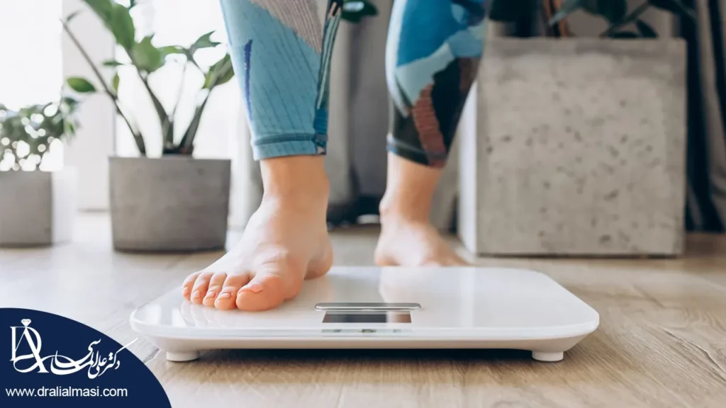 میزان کاهش وزن با اسلیو معده شاخص