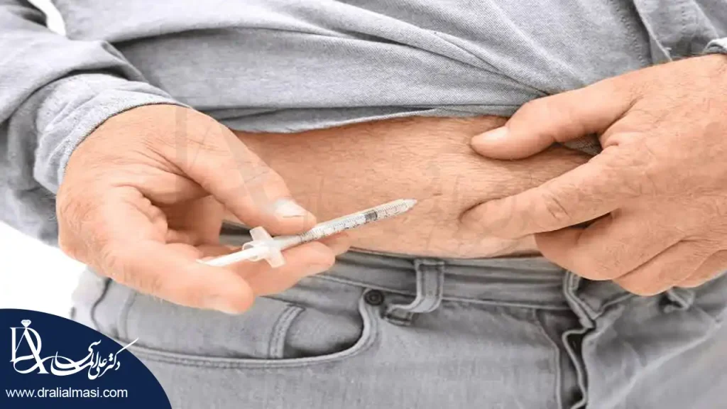 بررسی ماندگاری کاهش وزن و احتمال بازگشت وزن بعد از درمان چاقی